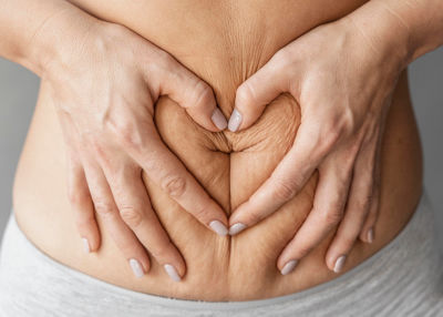 Manos formando un corazón sobre el abdomen de una persona con la piel arrugada