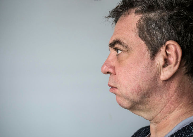 Hombre de perfil con cabello corto y expresión seria, mostrando papada