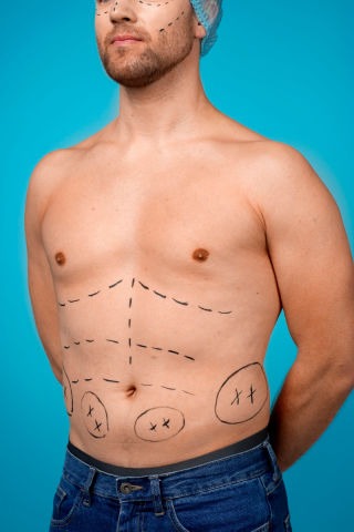 Torso masculino desnudo con varias líneas punteadas dibujadas en el abdomen sobre fondo azul